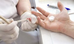 Симптомы пониженного сахара в крови у женщин