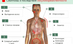 Как снизить инсулинорезистентность