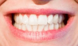 Лечение зубов при сахарном диабете: важные советы и правила