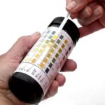 Ацетон в моче при сахарном диабете 1 и 2 типа: что делать с кетоновыми телами?